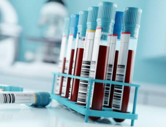 Тест на гемоглобін A1C (HbA1c)